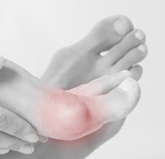 00_Header_Hallux