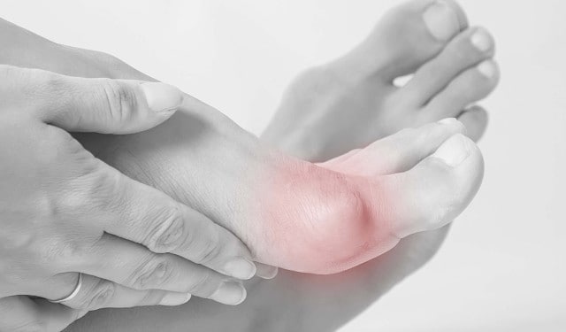 02_2_Hallux