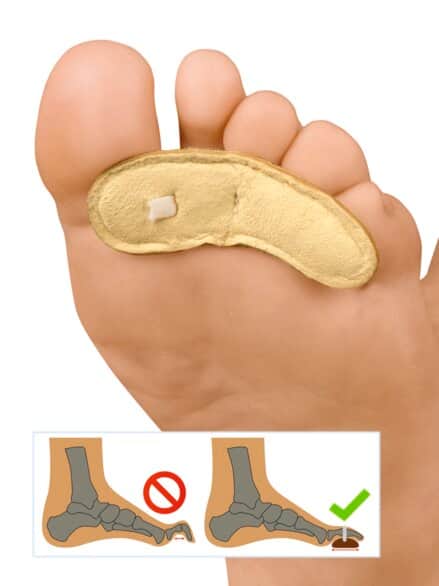 Hammerzeh-Kissen 2 Paar (4Stück) Haut