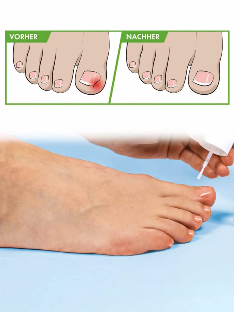 Nagel-Weichmacher Transparent